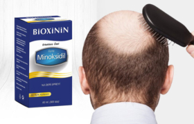 minoksidil-nedir-sprey