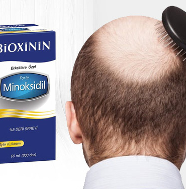 minoksidil-nedir-sprey