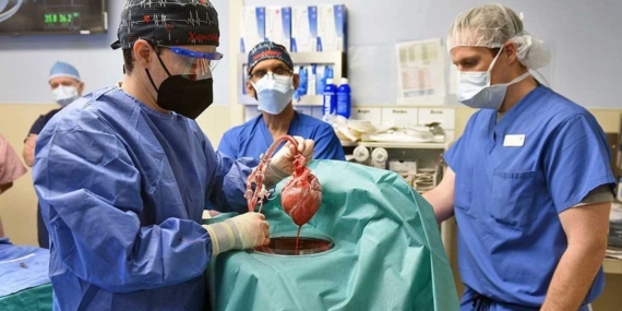 Organ naklinde devrim: Domuzdan insana kalp nakli yapıldı