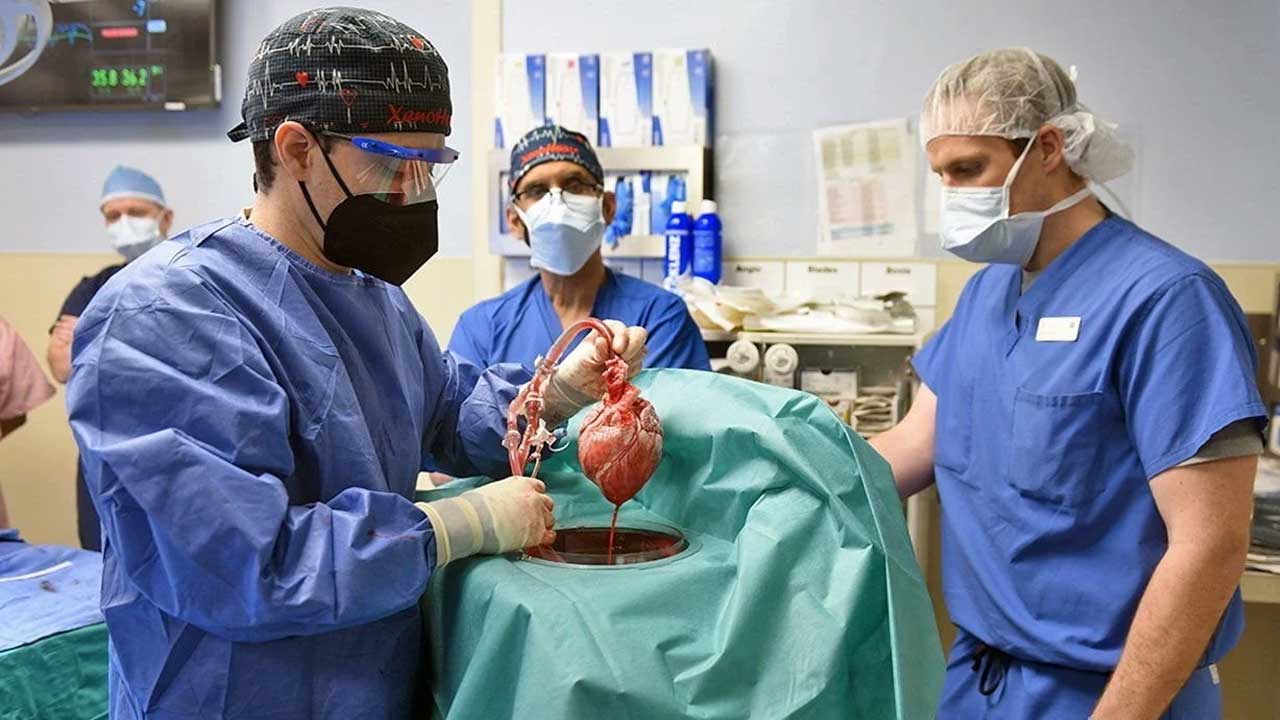 abd-de-david-bennett-isimli-kalp-hastasina-domuz-kalbi-nakledildi-2-a24haber