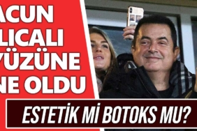 acun-ılıcalı-yüzündeki-şiş-neden-acun-ılıcalı-göz-estetik-botoks-ameliyat-a24haber