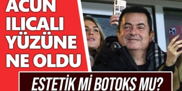 acun-ılıcalı-yüzündeki-şiş-neden-acun-ılıcalı-göz-estetik-botoks-ameliyat-a24haber