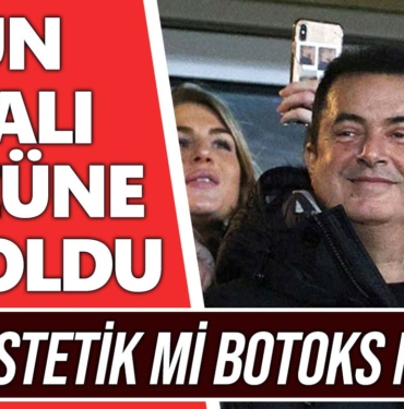 acun-ılıcalı-yüzündeki-şiş-neden-acun-ılıcalı-göz-estetik-botoks-ameliyat-a24haber