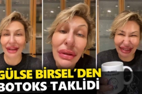 gülse-birsel-botokslu-kadinlari-tiye-aldi-a24haber