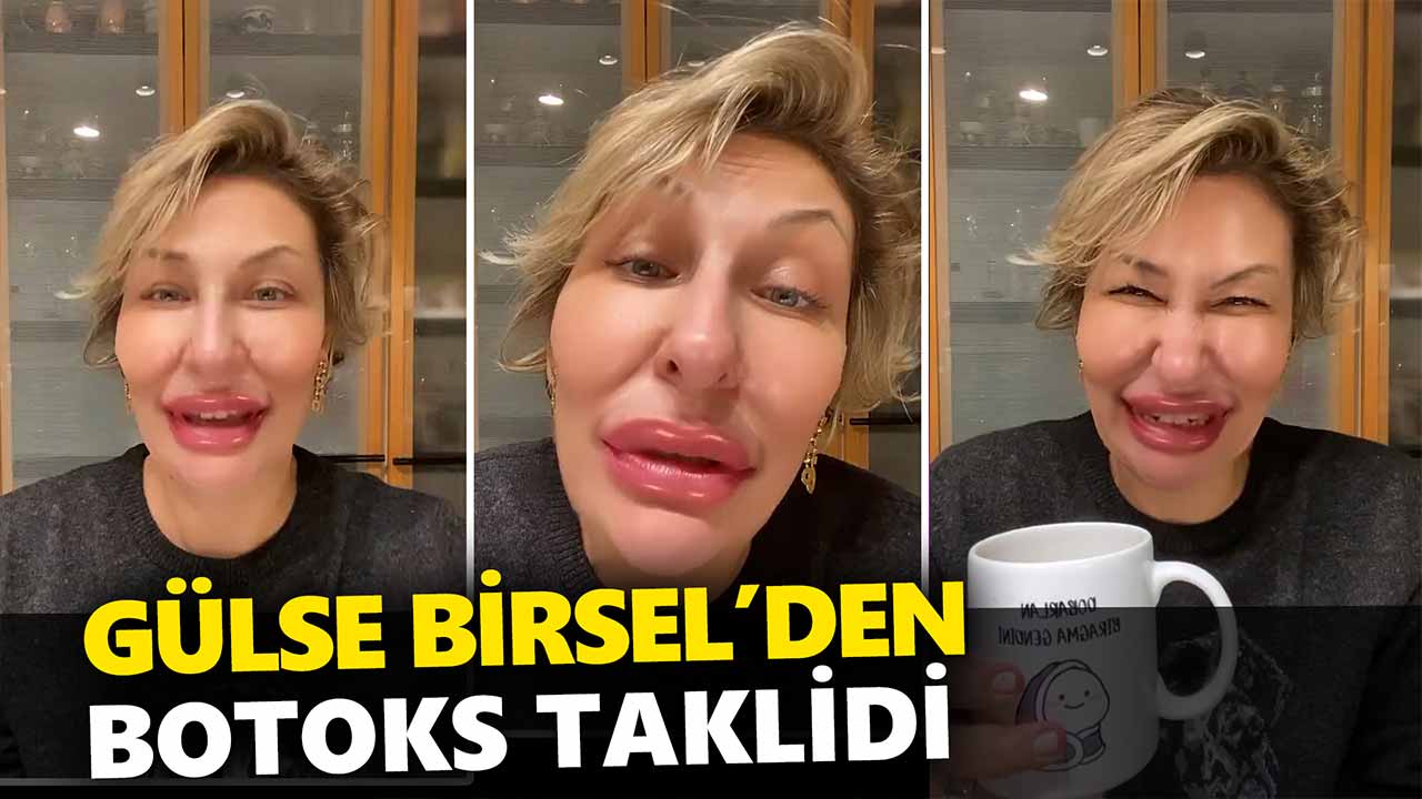 gülse-birsel-botokslu-kadinlari-tiye-aldi-a24haber
