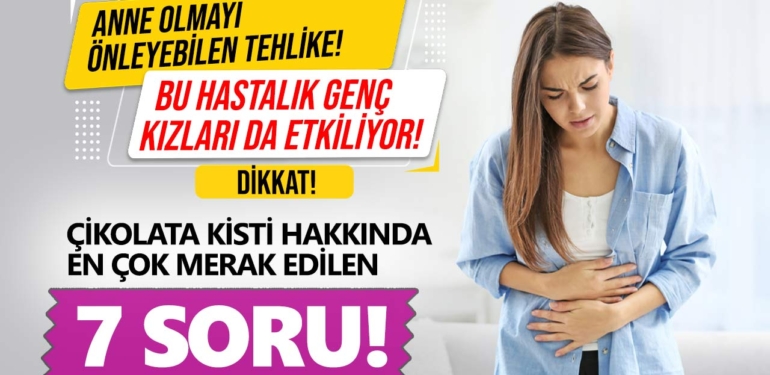 ÇİKOLATA KİSTİ HAKKINDA EN ÇOK MERAK EDİLEN 7 SORU!