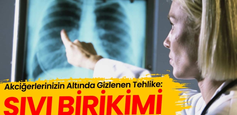 Nefes Darlığı Ve Ağrı Akciğerde Sıvı Birikmesine İşaret Edebilir