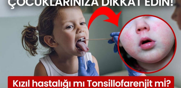Kızıl hastalığı mı yoksa Tonsillofarenjit mi? Çocuklarınıza dikkat edin..