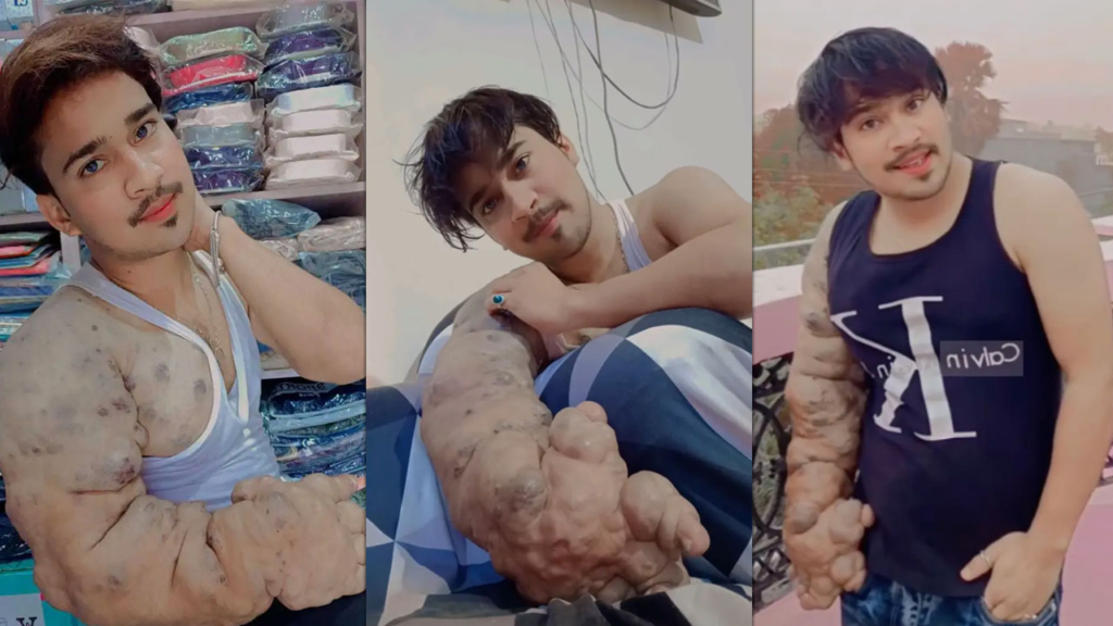 bilim insanlarının çözemediği hastalık