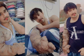 bilim insanlarının çözemediği hastalık