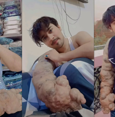 bilim insanlarının çözemediği hastalık