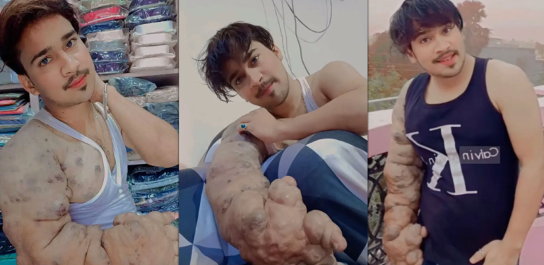 Kolu 3 tuğla ağırlığında! Bilim insanları şaşkın